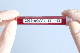 Coronavirus